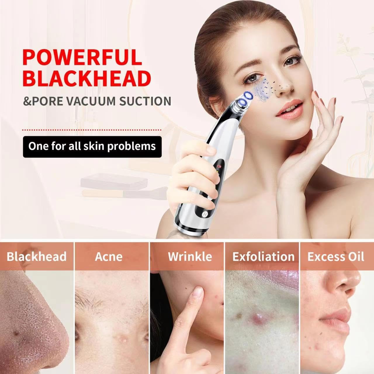 2024 Newest Blackhead Remover Pore Vacuum -  Professional Pimple Popper Tool Pore Vacuum Black Head Remover for Face - USB Rechargeable Blackhead Extractor for Removing Blackhead Whitehead Acne
