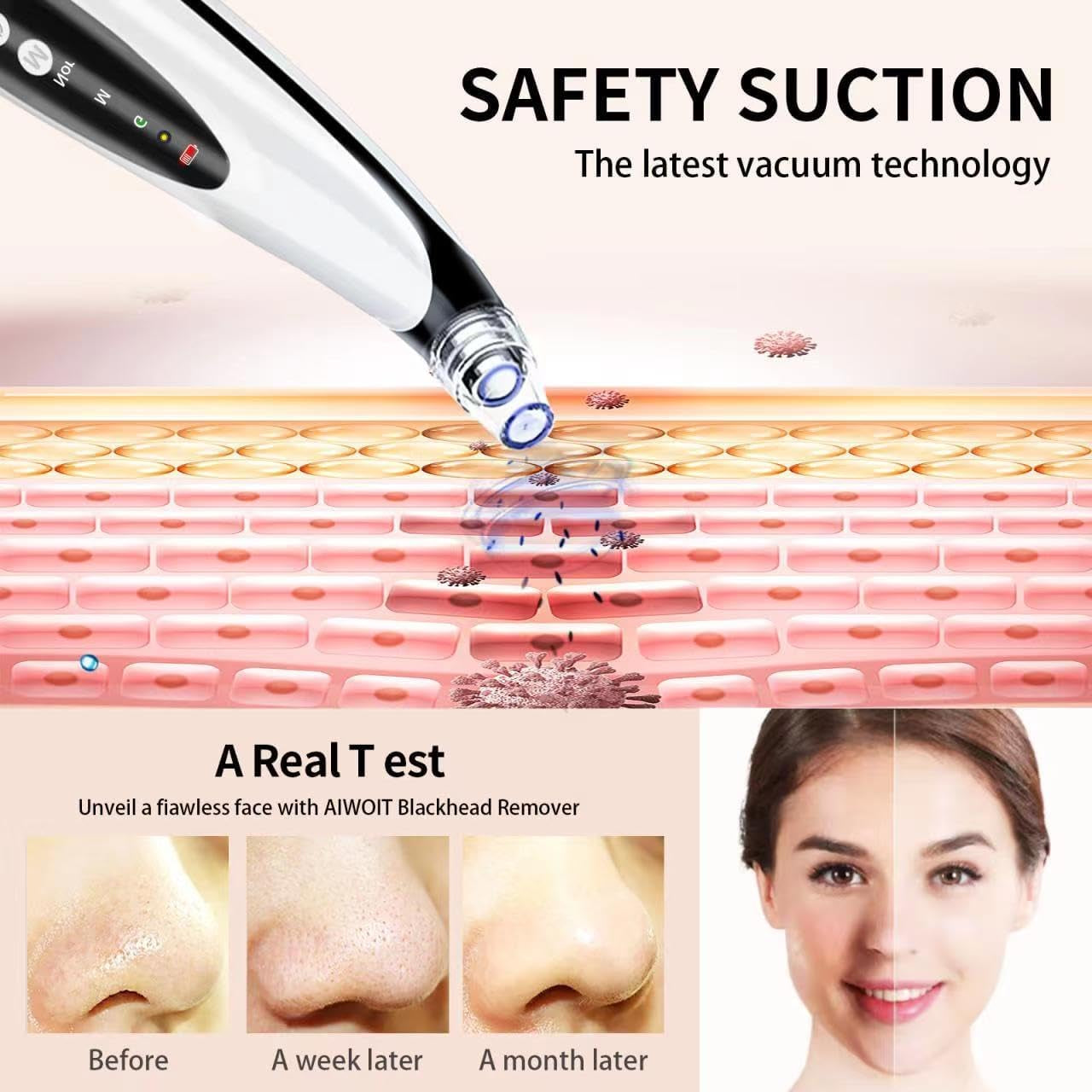 2024 Newest Blackhead Remover Pore Vacuum -  Professional Pimple Popper Tool Pore Vacuum Black Head Remover for Face - USB Rechargeable Blackhead Extractor for Removing Blackhead Whitehead Acne