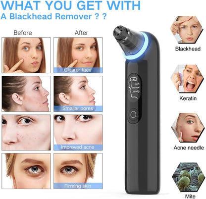 Blackhead Remover Pore Vacuum: Upgraded Facial Pore Cleaner with Blue Light, Electric Comedone Whitehead Extractor Tool- 4 Probes, 3 Suction Power,Usb Rechargeable Blackhead Vacuum Kit for Women & Men