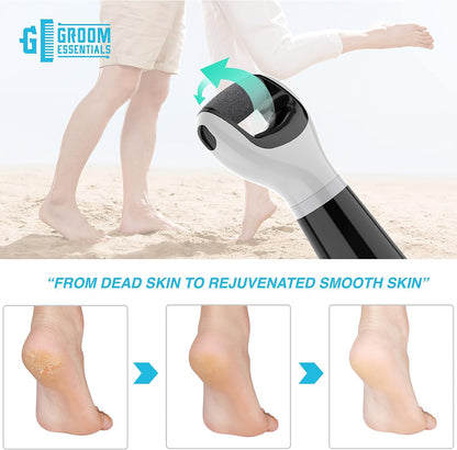 Groom Essentials Callus Remover for Feet | Battery-Run Electric Foot Callus Remover, Foot File, Pedicure Tools for Feet, 2 Spinning Pumice Heads for Cracked Skin, Pumice Stone for Feet